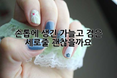 손톱에 생긴 가늘고 검은 세로줄, 괜찮을까요?