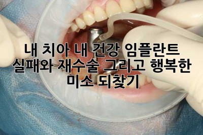 내 치아, 내 건강: 임플란트 실패와 재수술, 그리고 행복한 미소 되찾기